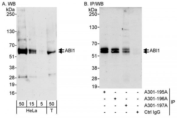 Anti-ABI1