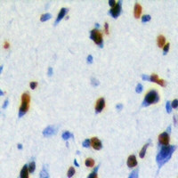 Anti-LUC7L2