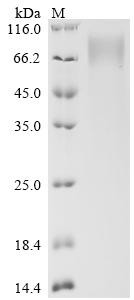 Heat-stable enterotoxin receptor (GUCY2C), partial, recombinant Macaca fascicularis