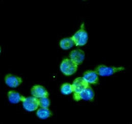 Anti-IRF5, clone 10T1