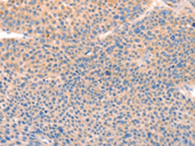 Anti-CD109