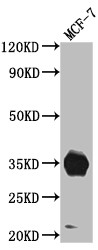 Anti-IGFBP2 Recombinant Monoclonal, clone 7G11