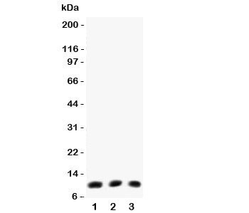 Anti-Eotaxin