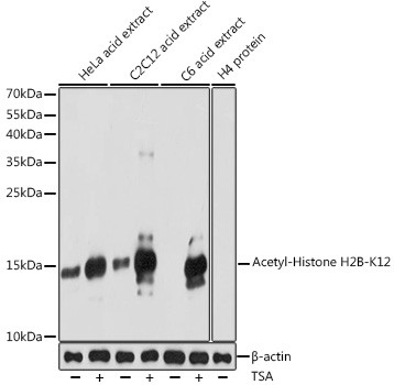 Anti-Acetyl-Histone H2B (Lys12)