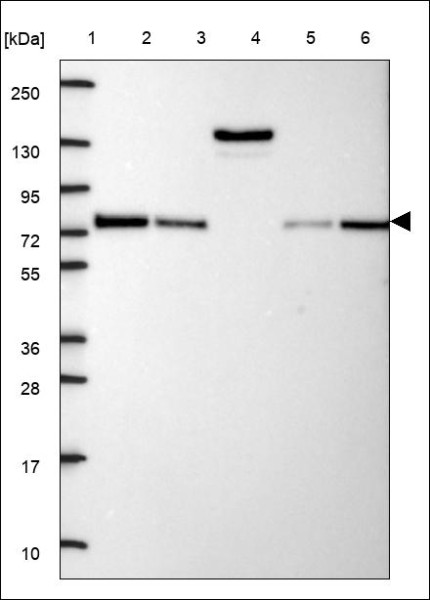 Anti-PGM2