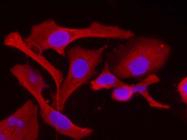 Anti-HSP-27