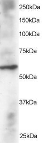 Anti-DUSP8 / HVH5, N-terminal