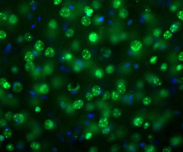 Anti-MeCP2