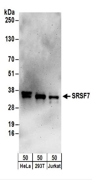 Anti-SRSF7