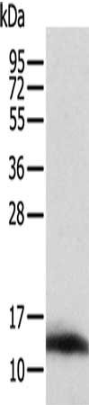 Anti-ACYP1