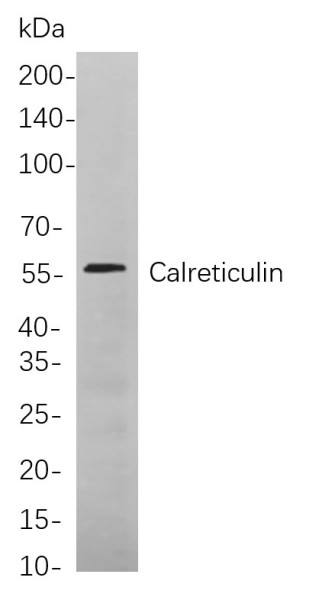 Anti-Recombinant Calreticulin, clone 5A7