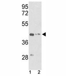 Anti-g-Actin (ACTG1)