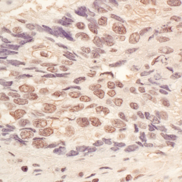 Anti-L3MBTL3