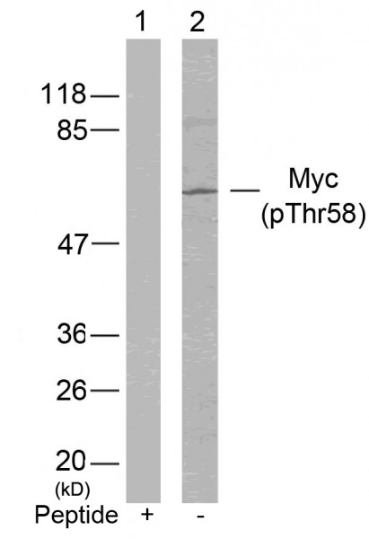 Anti-phospho-c-Myc (Thr58)