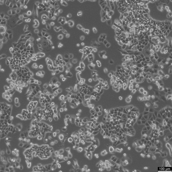 HEC-1-B Cells