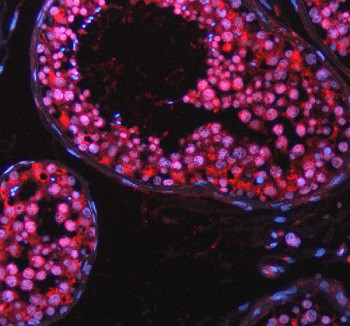 Anti-TAOK2 / TAO kinase 2