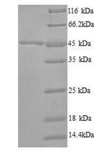 3-Oxoacyl-[acyl-carrier-protein] synthase 2 (fabF), Bacillus subtilis, recombinant