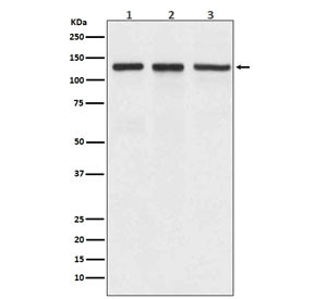 Anti-Integrin alpha V / ITGAV, clone ABGC-9