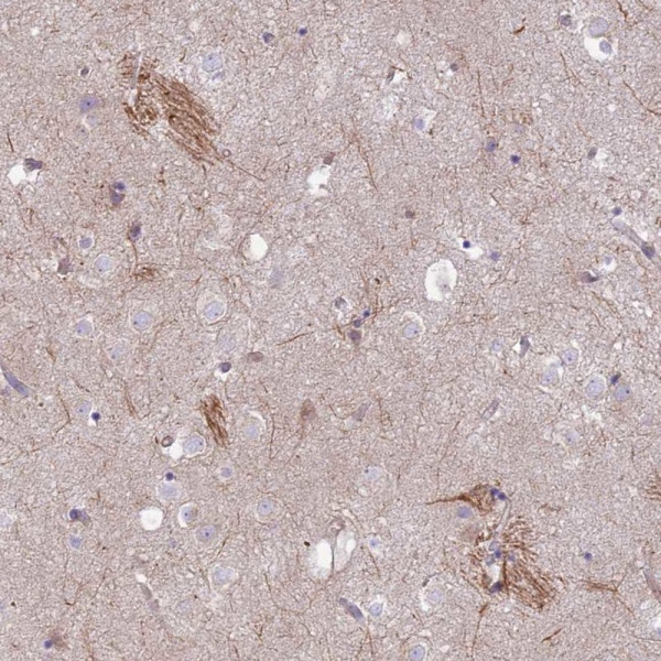Anti-KCNAB1