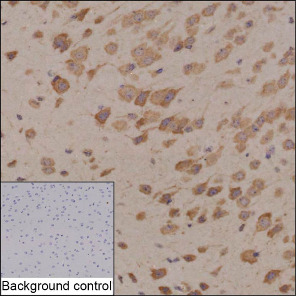 Anti-Trpm2