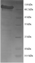 Tyrosine--tRNA ligase, Cytoplasmic domain (YARS1), human, recombinant