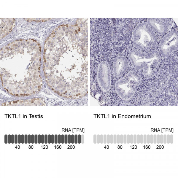 Anti-TKTL1