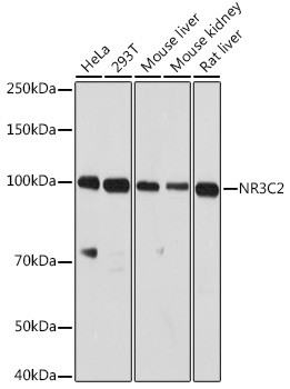 Anti-NR3C2