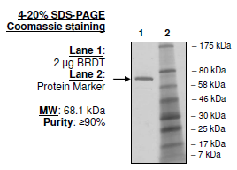 BRDT, BD1 and BD2 (22-382), GST-tag, human recombinant protein