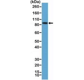 Anti-BRAF (N-Terminal Region) (recombinant antibody), clone RM308