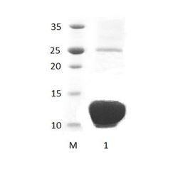 DLG2_2 PDZ Domain