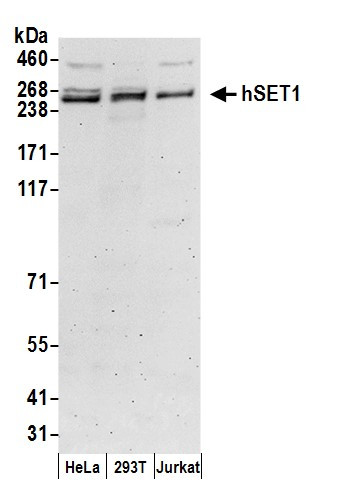 Anti-hSET1