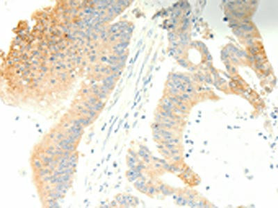 Anti-PTGES3