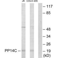 Anti-PPP1R14C