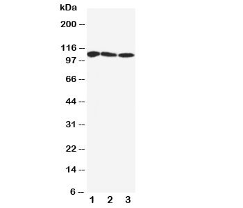 Anti-SERCA1 ATPase