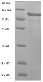 L-2-hydroxyglutarate dehydrogenase, mitochondrial (L2HGDH), human, recombinant
