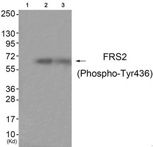 Anti-Phospho-FRS2 (Tyr436)