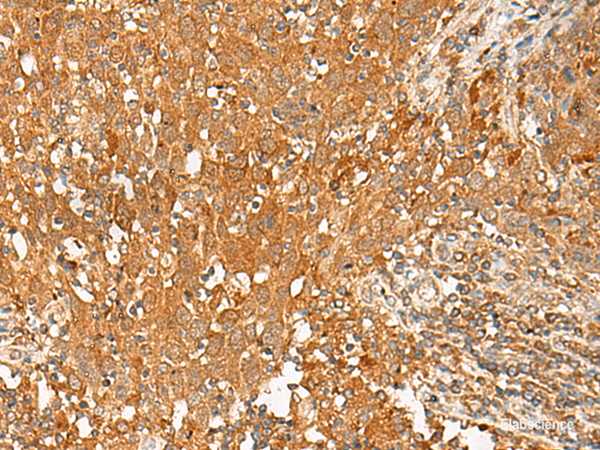 Anti-GPR1