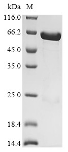E3 ubiquitin-protein ligase AMFR (AMFR), partial, Biotinylated, human, recombinant