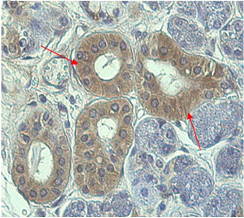 Anti-TRB-3 (human)