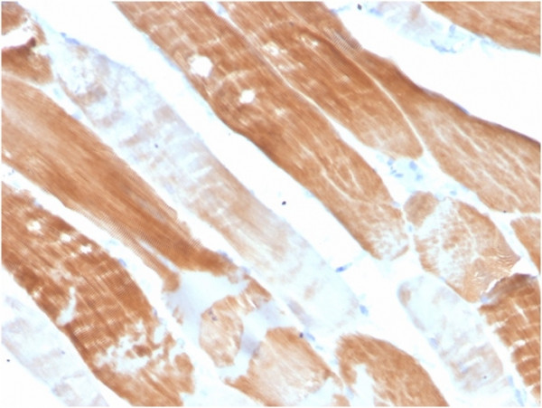 Anti-Sarcomeric Actinin Alpha 2 / ACTN2, clone ACTN2/3291