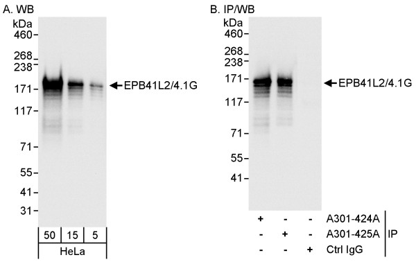 Anti-EPB41L2/4.1G