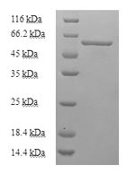 Uncharacterized aarF domain-containing protein kinase 2 (Adck2), partial, mouse, recombinant