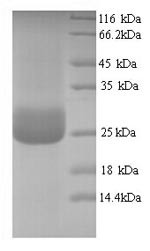 CMRF35-like molecule 1 (CD300LF), partial, human, recombinant