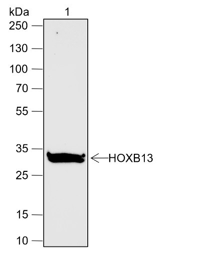 Anti-Recombinant HOXB13, clone A632