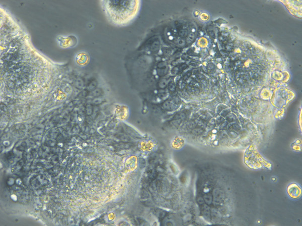 HROC183 T0 M2 Cells