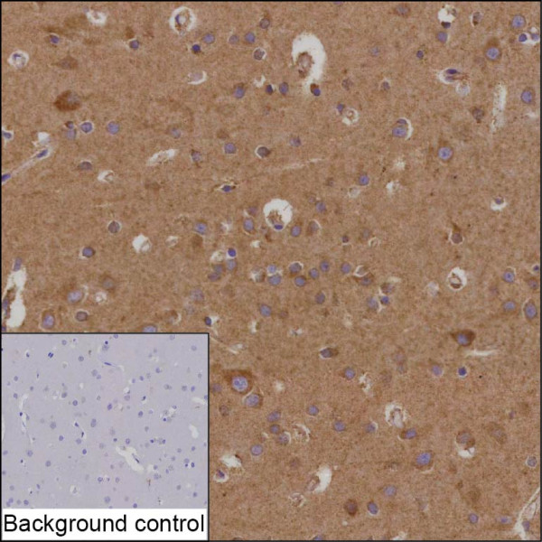Anti-MTERF2 (recombinant antibody)