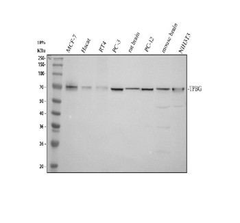 Anti-TPBG / Trophoblast glycoprotein