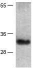 Anti-TFF3, monoclonal