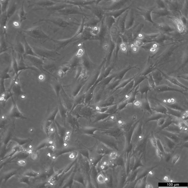 15P-1 Cells