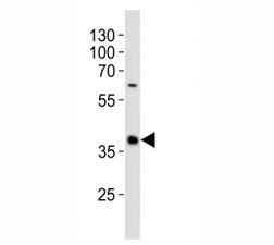 Anti-CD40